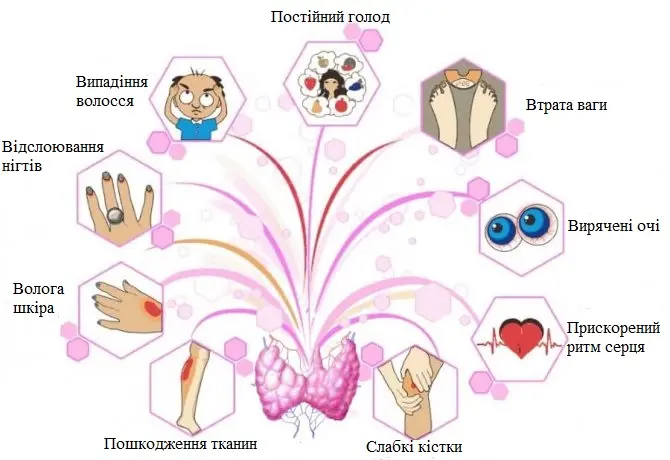 Симптоми гіпертиреозу, добавки при захворюванні